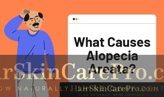 Alopecia Areata: A Comprehensive Guide 2025