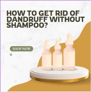 Complete Guide to how to get rid of dandruff without shampoo