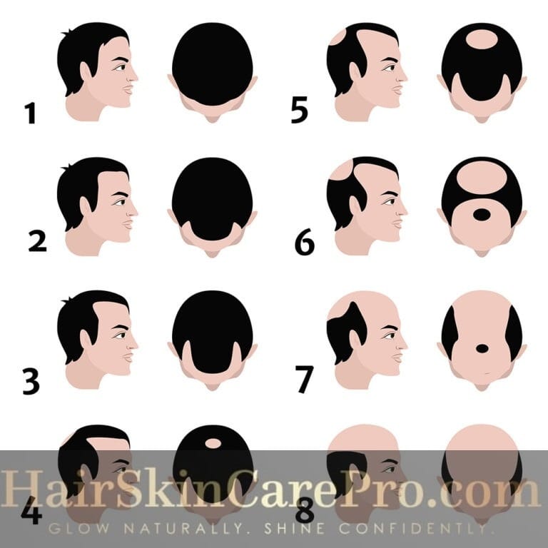 Understanding and Managing a Receding Hairline: A Comprehensive Guide 2025