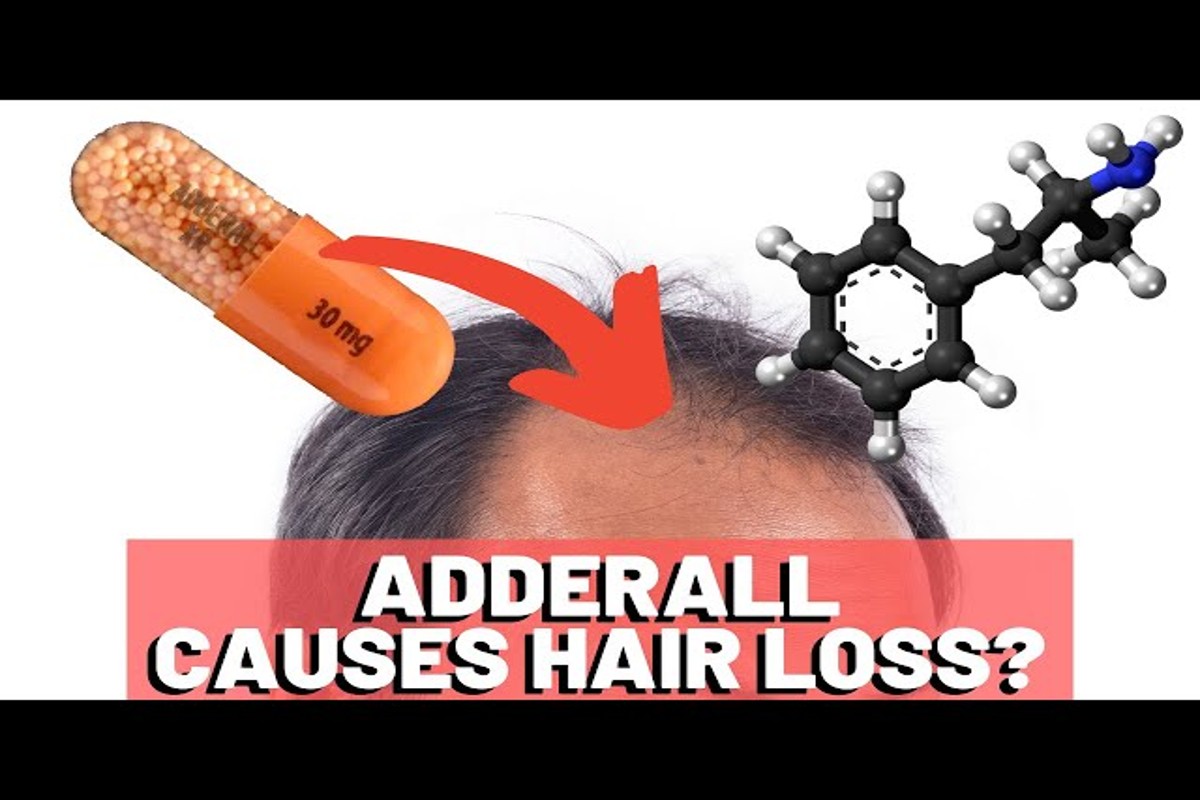 Can Adderall Cause Hair Loss? Insights and Solutions